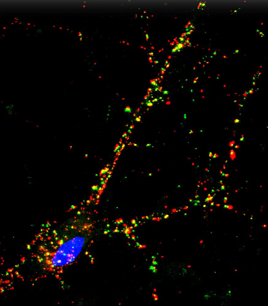 Immune-based staining shows synapse markers (red, green) and the cell’s nucleus (blue).