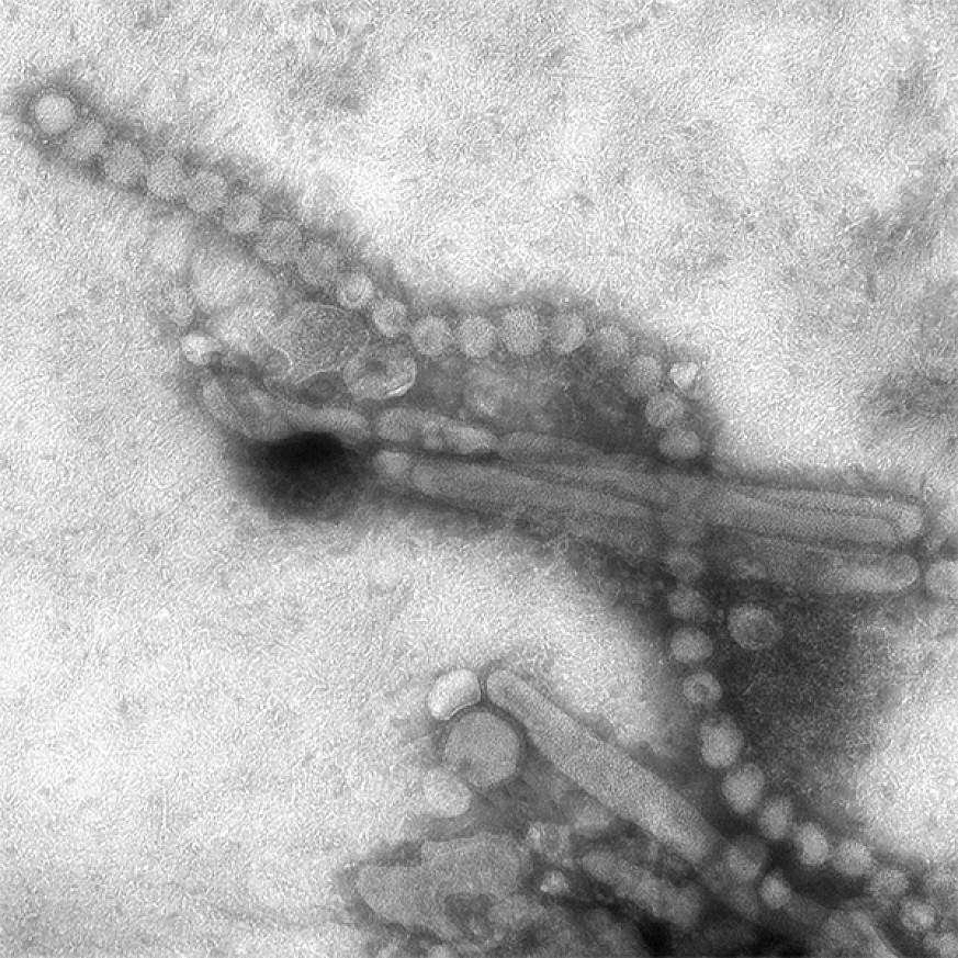 An image of the H7N9 influenza virus