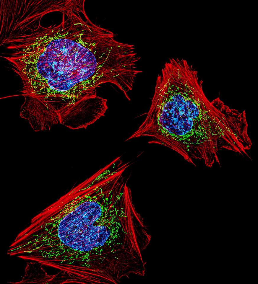 Microscopic image of fibroblasts