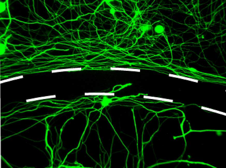 Barrier used to develop spinal cord injury drug