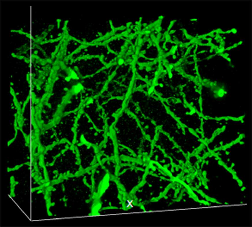 Image of diaper compound used to expand brain cells
