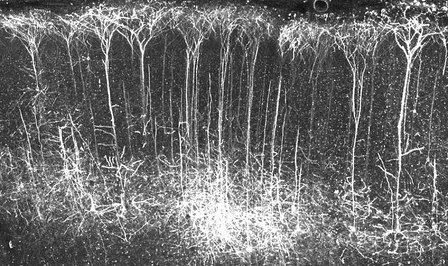 Striatal neurons in the rat brain