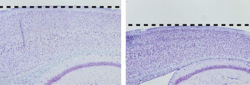 Image showing the effects on mouse cortex of an Alzheimer’s-causing mutation
