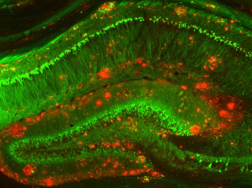 Image of mouse brain in Alzheimer’s model