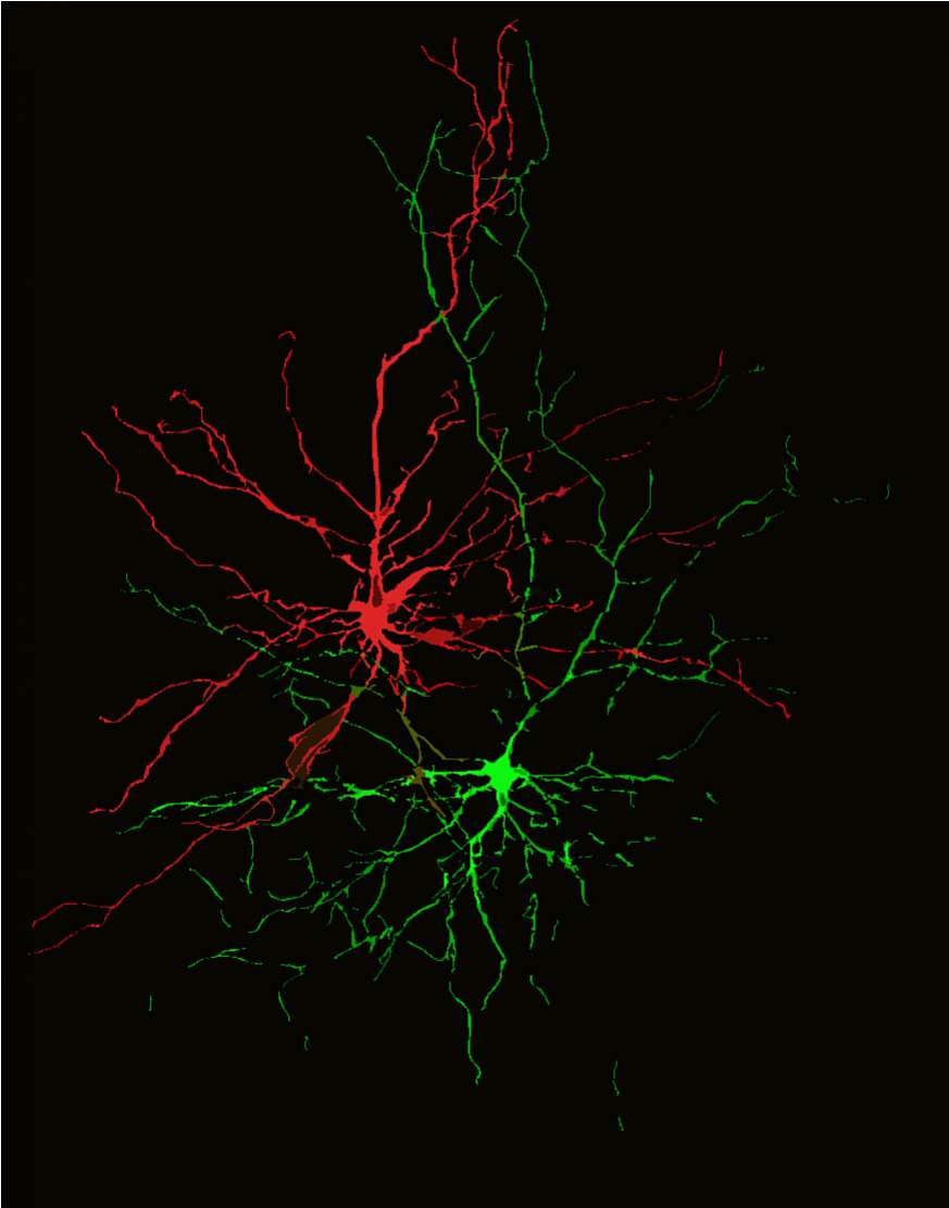 Image showing neural projections of negative and positive associations. 