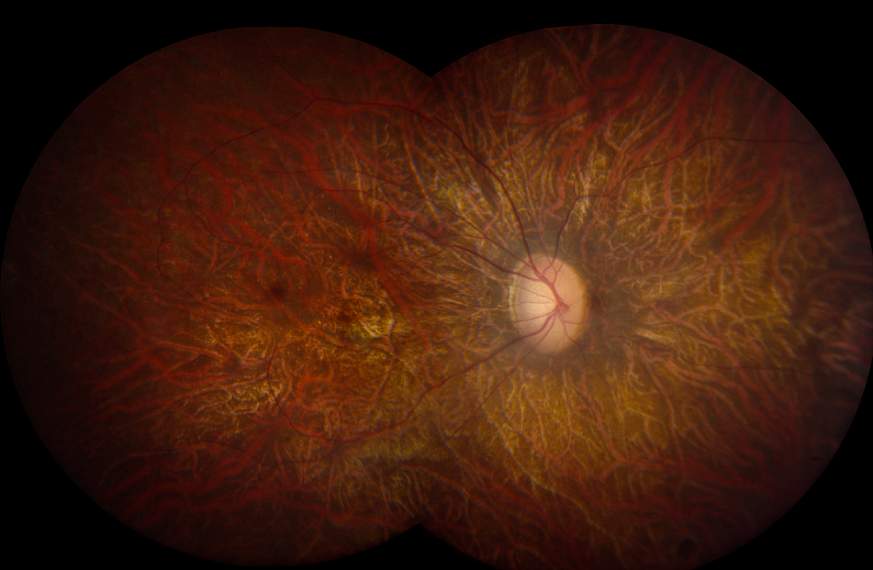 Image of a retina.