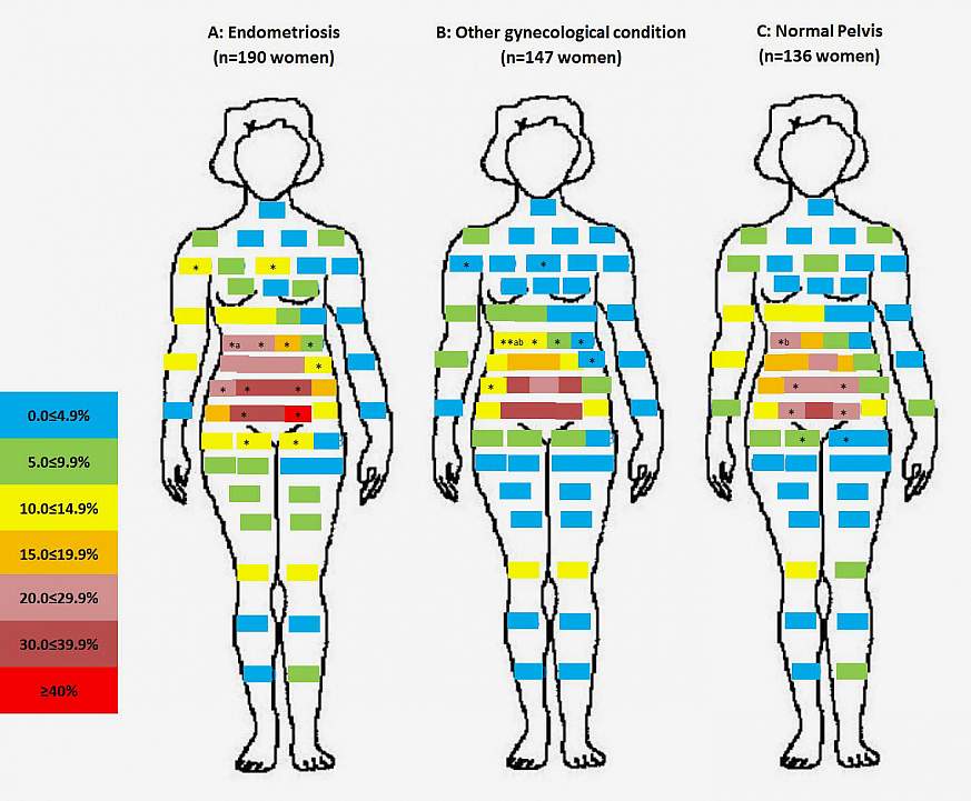 Diagram of bodily areas where women reported feeling pain.