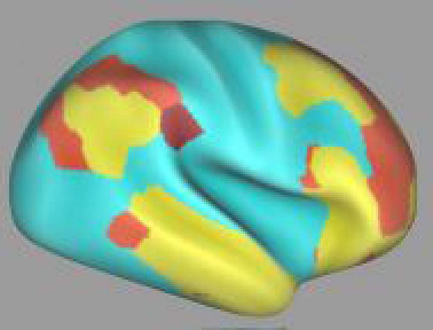 Illustration of a human brain