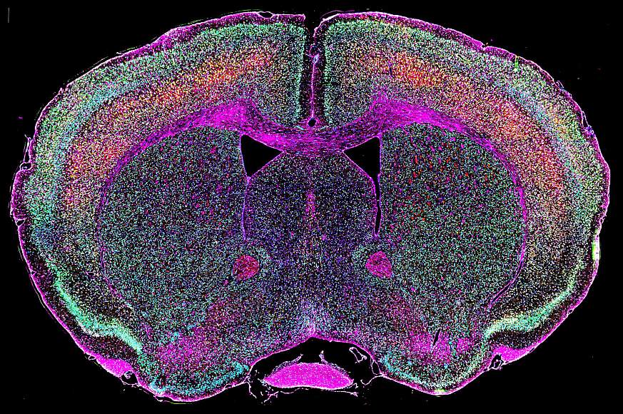 Image of a brain scan