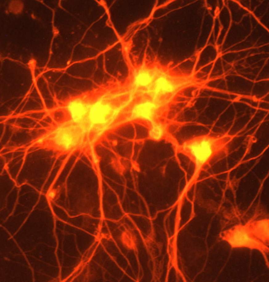 beeld van neuronen in een schotel behandeld met GDF10