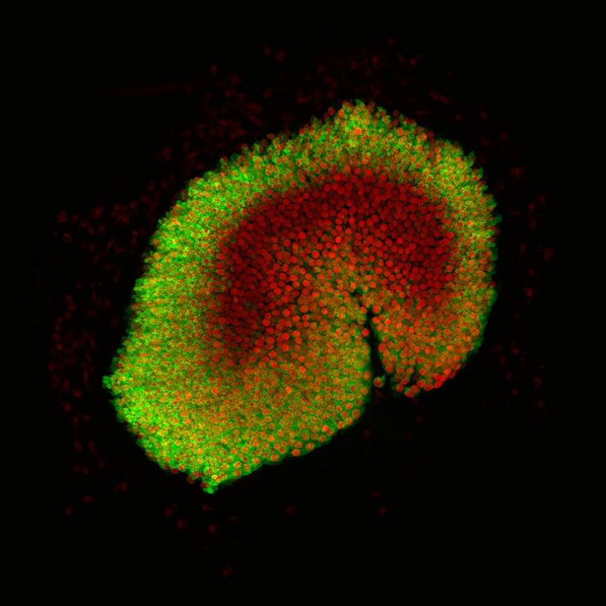 Image of balancing apparatus of the inner ear