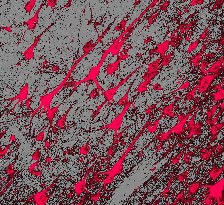 Image of a brain slide