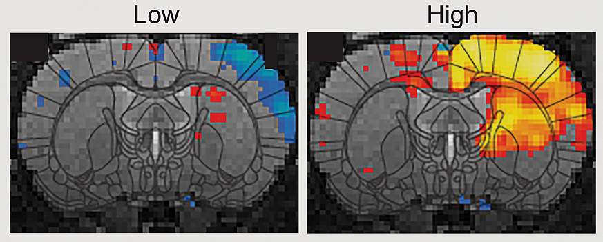 fMRI activity brain scans