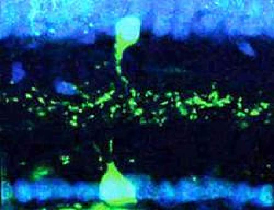 Object motion and amacrine cells in retina