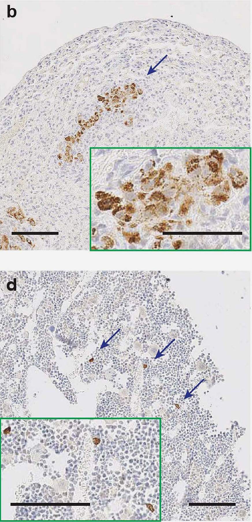 Images of metastasized cells in mice