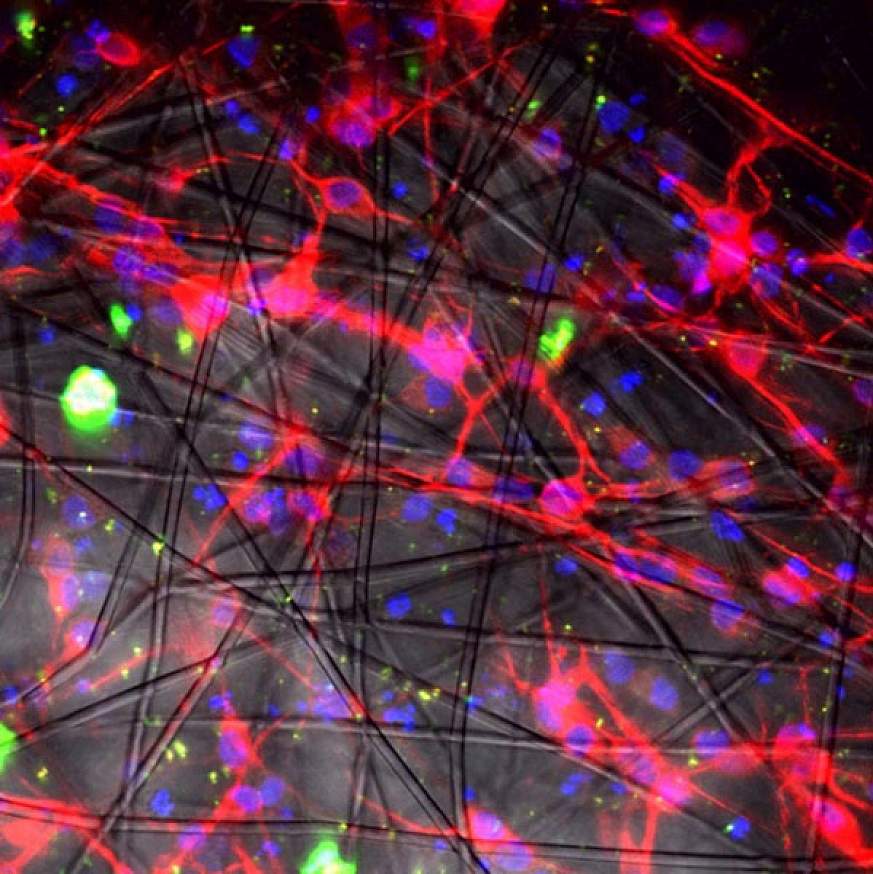 Image of human neurons