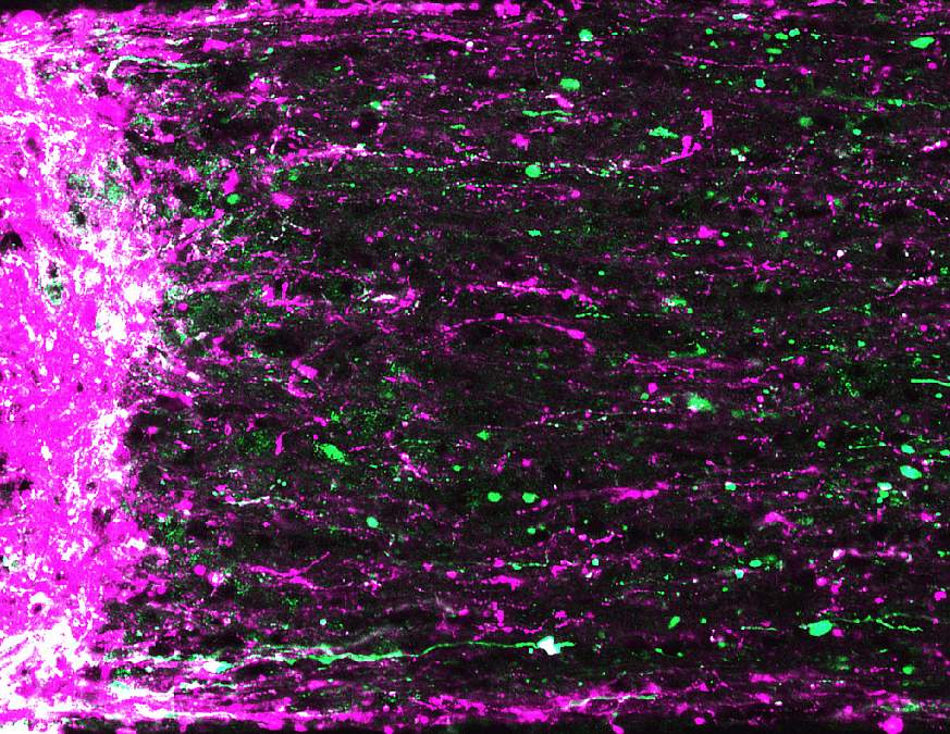 An image of axons regenerating