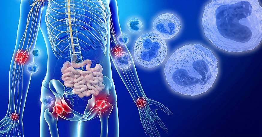 Illustration depicting inflammation in the body