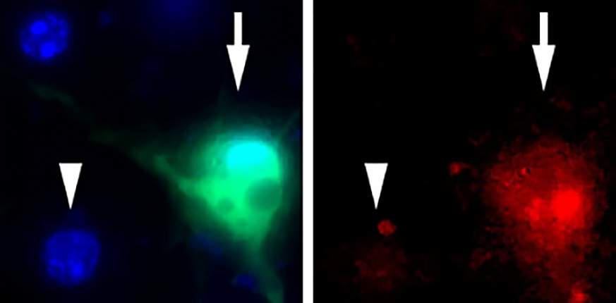 Image of laboratory grown neurons