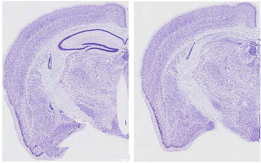  Image of mice brains