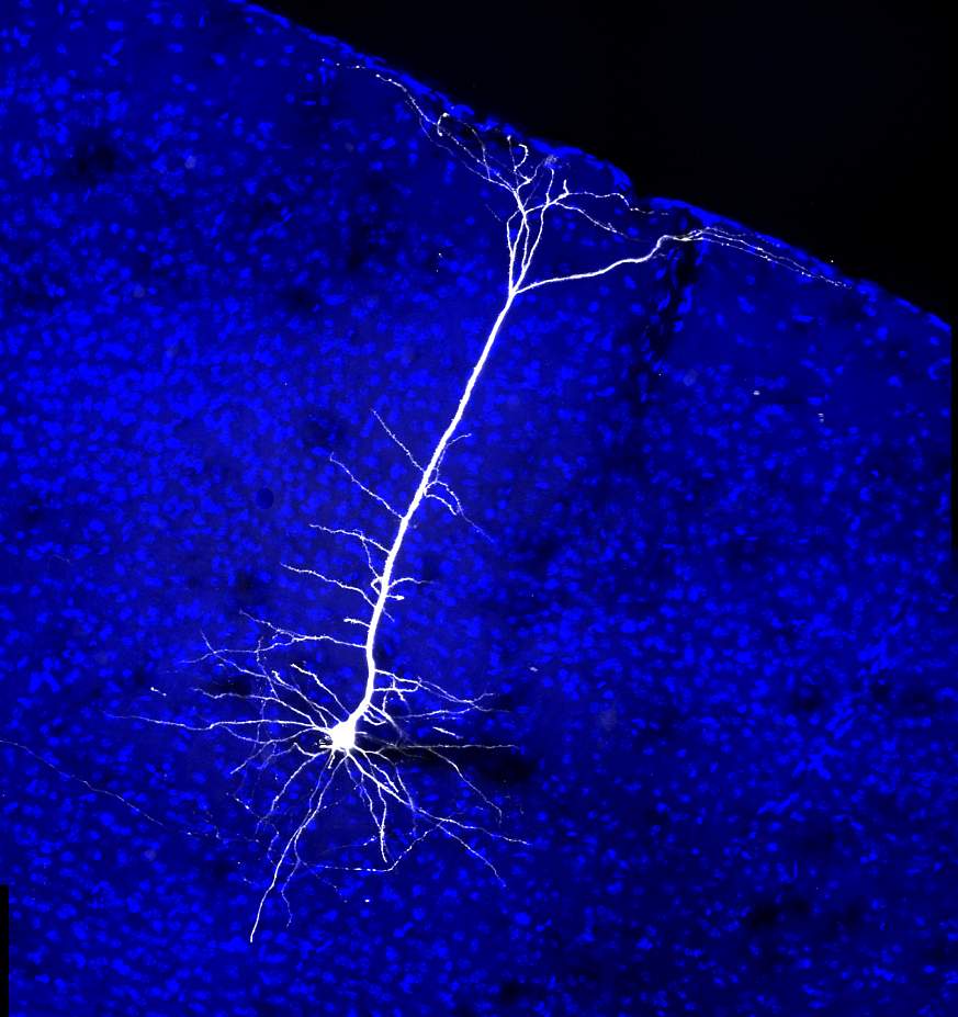 Image of a neuron projecting from the visual cortex