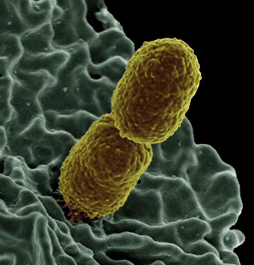 Klebsiella pneumoniae