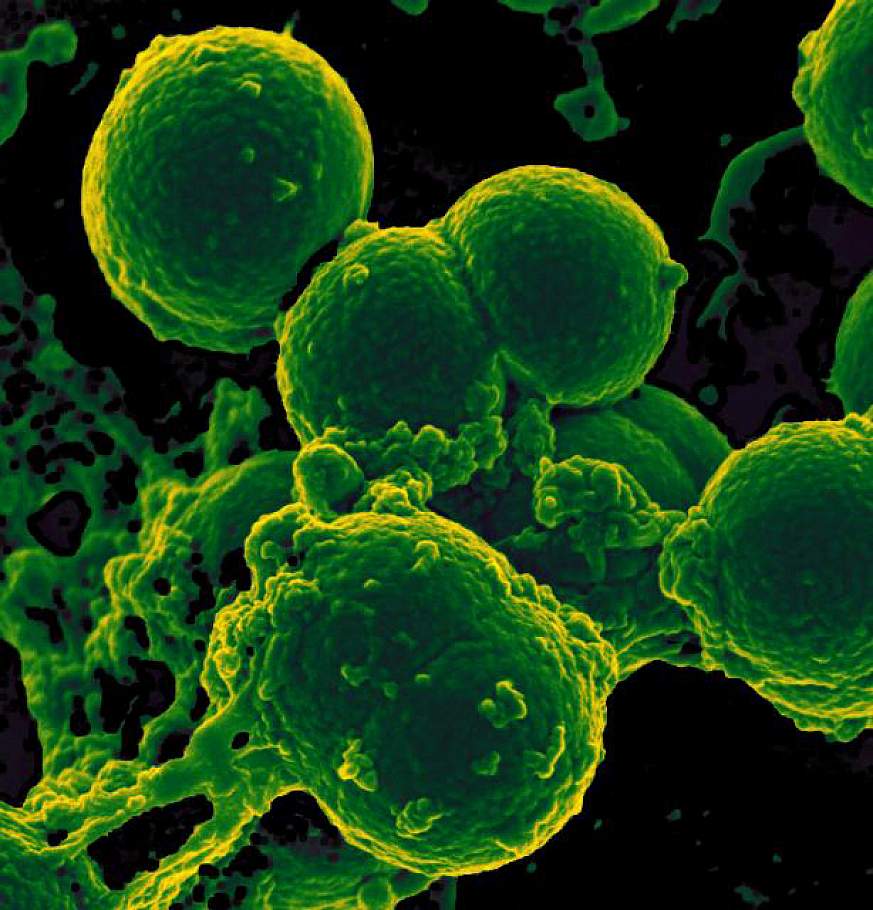 Scanning electron micrograph of neutrophil ingesting methicillin-resistant Staphylococcus aureus bacteria. 