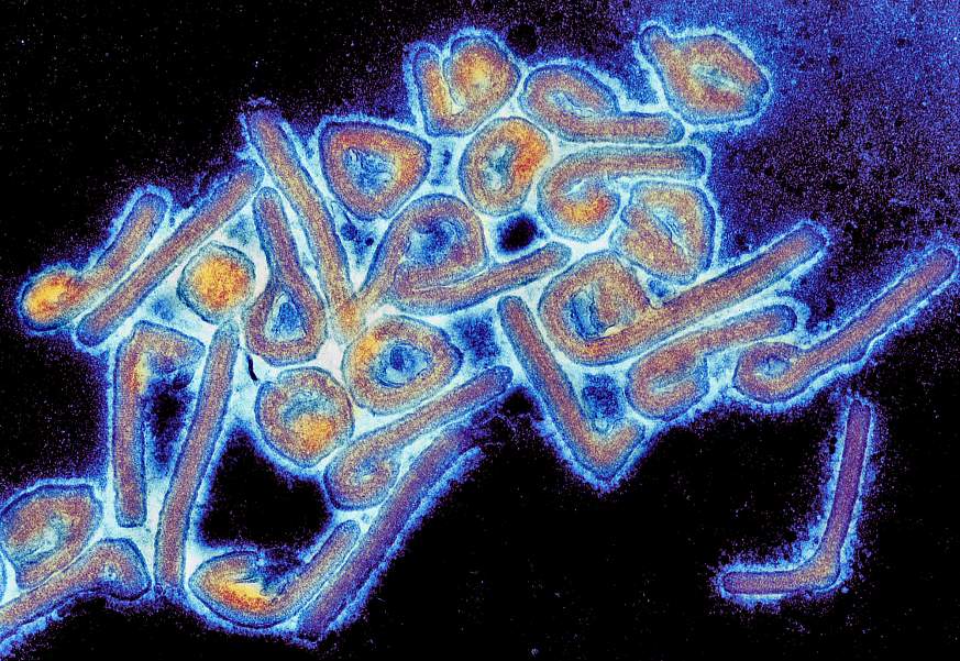 Colorized electron micrograph of Marburg virus.
