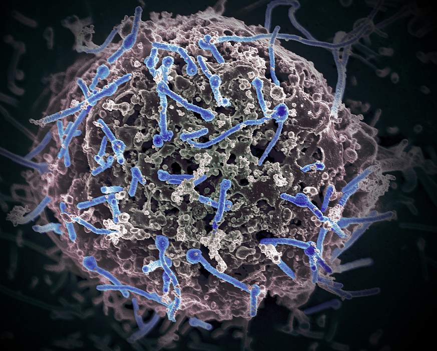 Ebola Virus From Mali Blood Sample