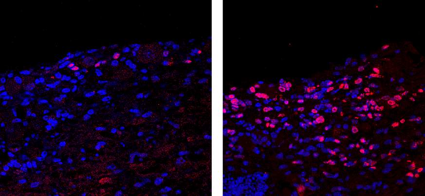 Images of HSV reactivation.