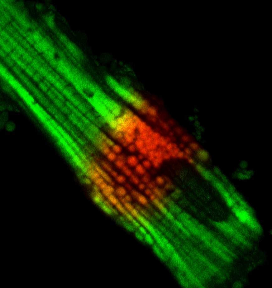 Image of mitochondria within a single heart cell