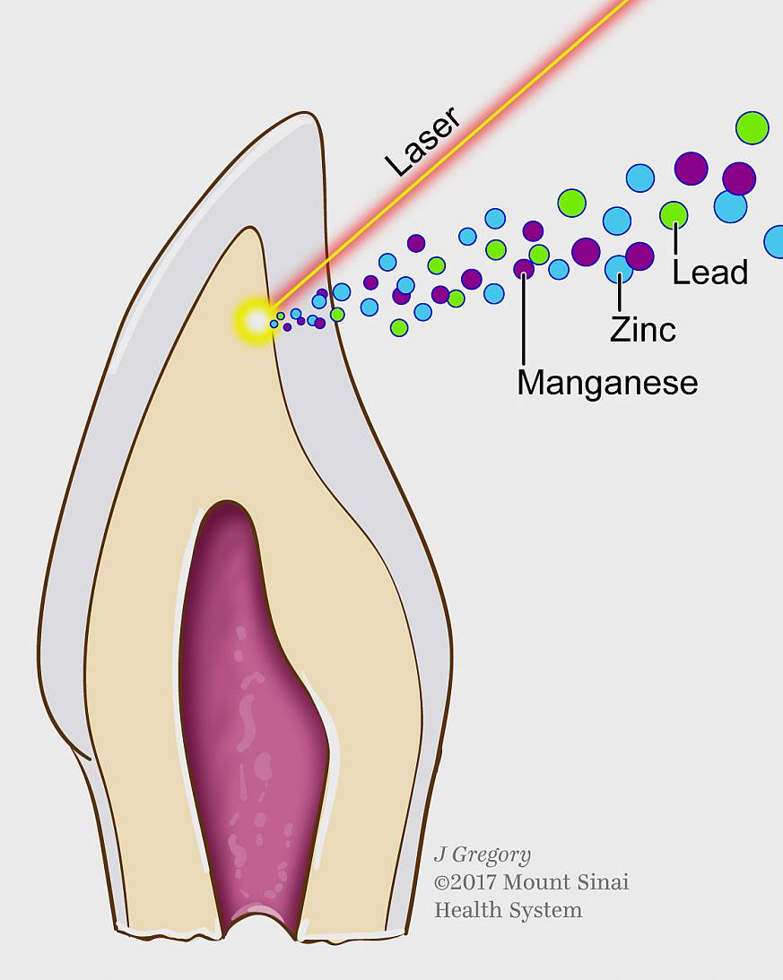 Cross-section of tooth