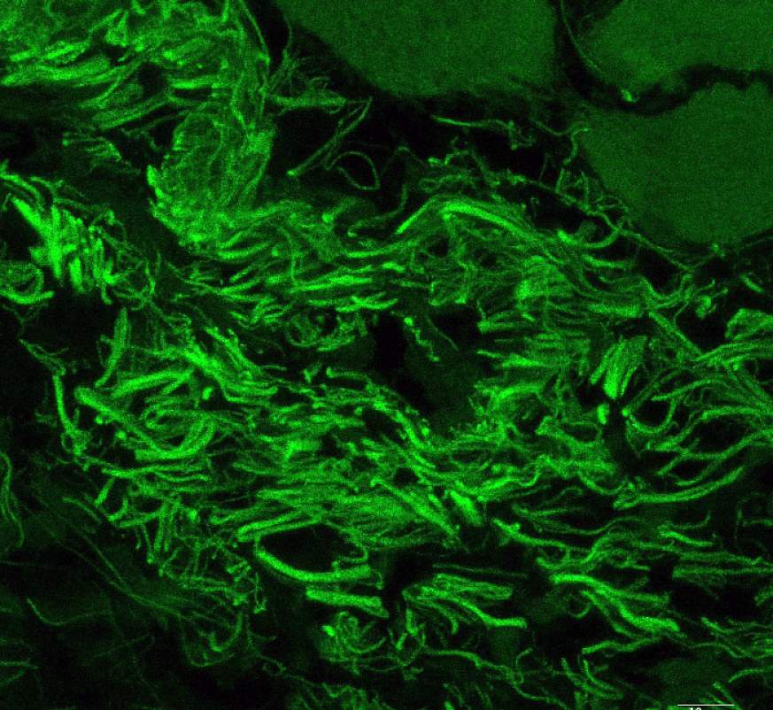 Image of C. mast bacteria