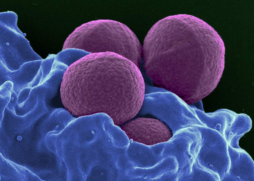 Methicillin-Resistant Staphylococcus aureus (MRSA)