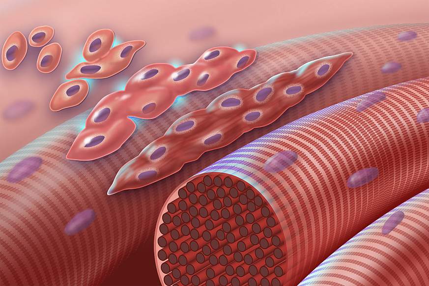 Illustration of normal myoblasts