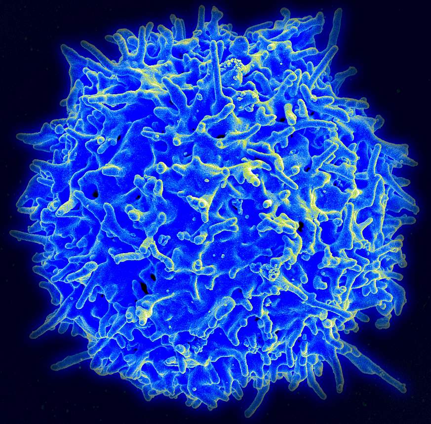T cell from a healthy person