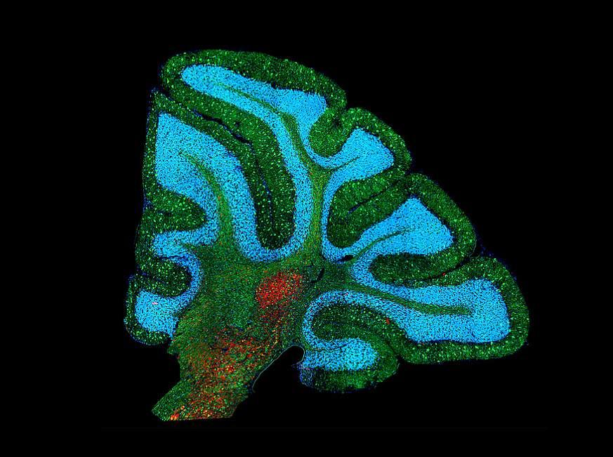 Mouse brain with Niemann-Pick disease type C1