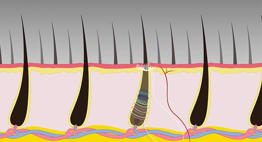 Illustration of hair follicles