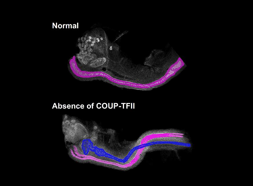 Reproductive tract of female mouse embryo