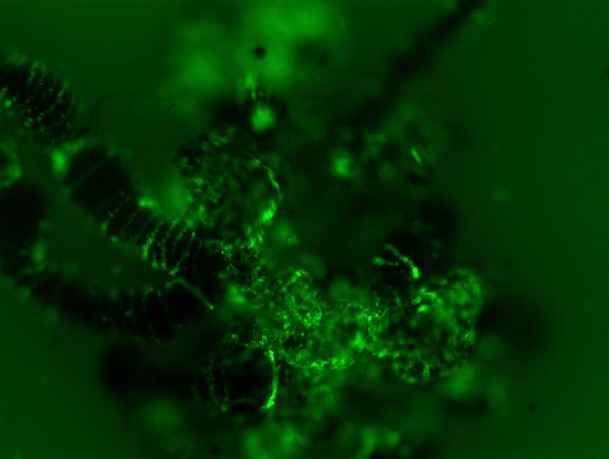 Image of Langat virus infection in the tick gut