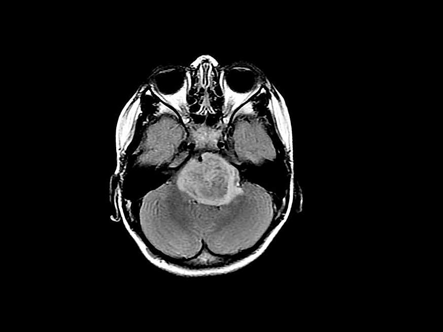  Image of a brain scan