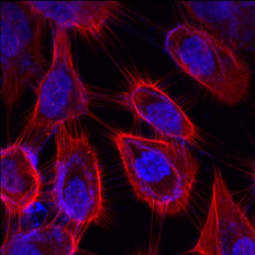 Image of oral cancer cells.