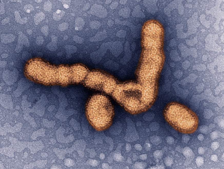 H1N1 influenza virus particles