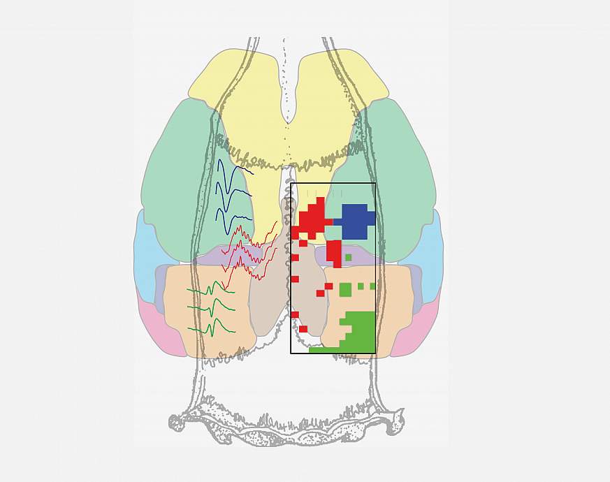 Image of a NeuroGrid map