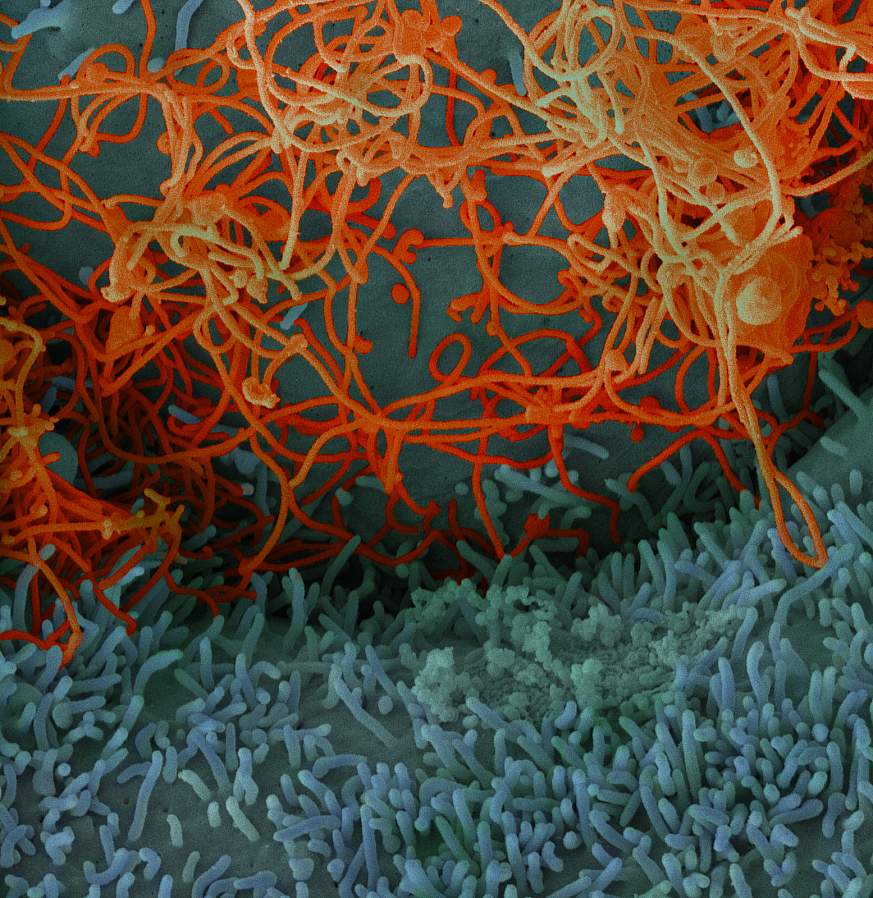 Ebola virus from Mali blood sample
