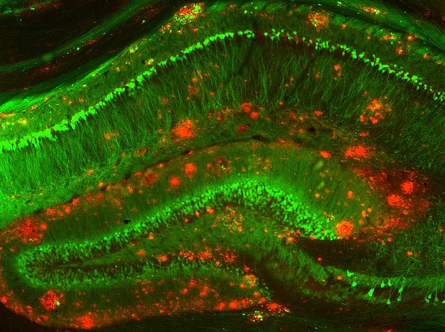 Mouse model of Alzheimer's disease.