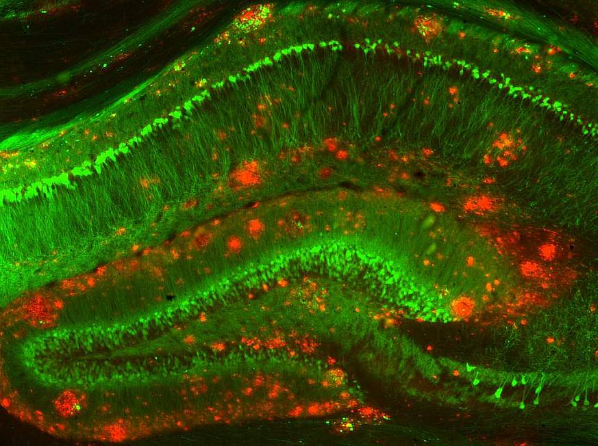 Mouse model of Alzheimer's disease.