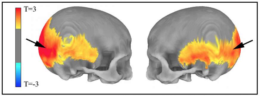 Images of brain scans