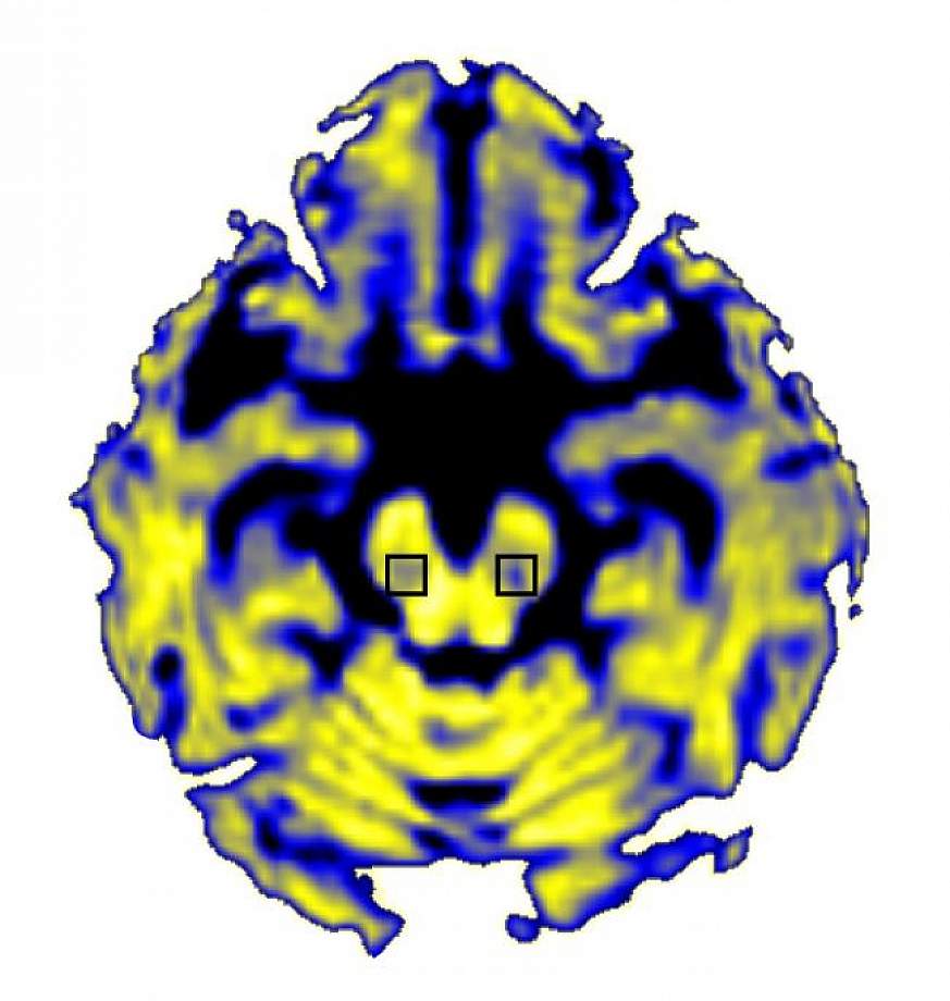 Image of a brain scan.