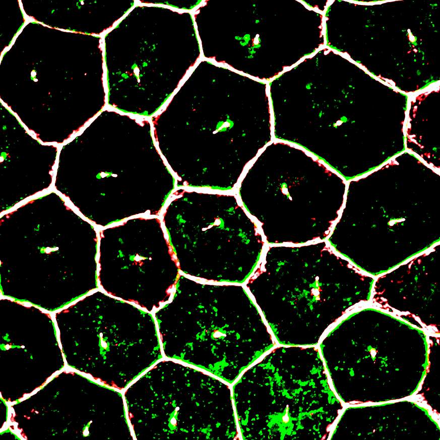 Image of mature iPSC-derived RPE cells under super resolution